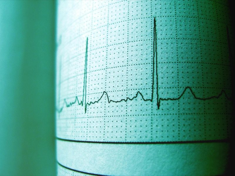 Cardiology